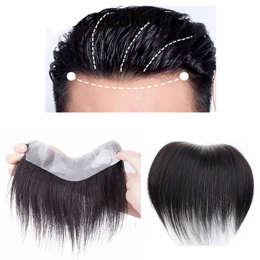 Frontal Hairpiece Extension Hairline Loss Straight Natural Brazilian Black Human Hair Tape in Toupee Replacement System