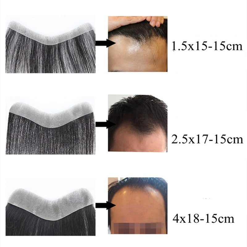 Frontal Hairpiece Extension Hairline Loss Straight Natural Brazilian Black Human Hair Tape in Toupee Replacement System